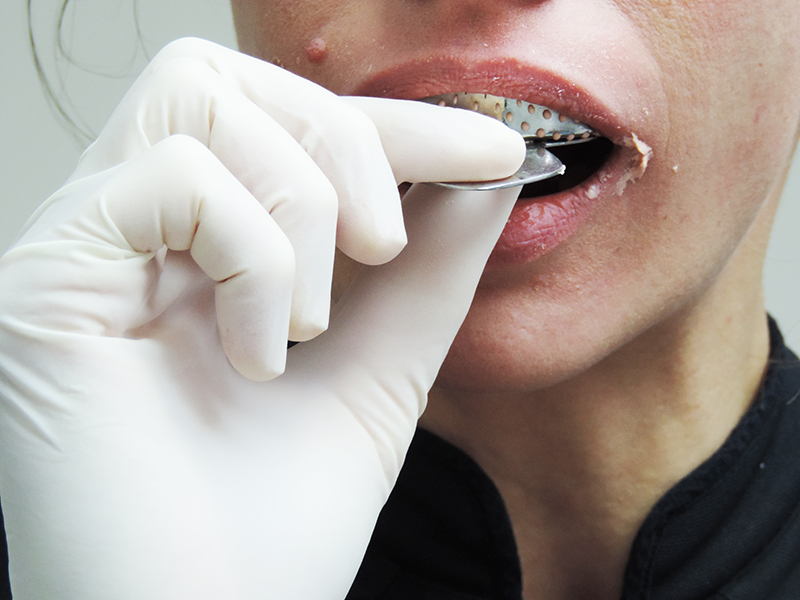 Dentiste qui prend une empreinte pour faire un protège dents pour le JJB